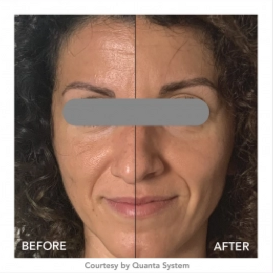 Hollywood peel !!! Colección Vip