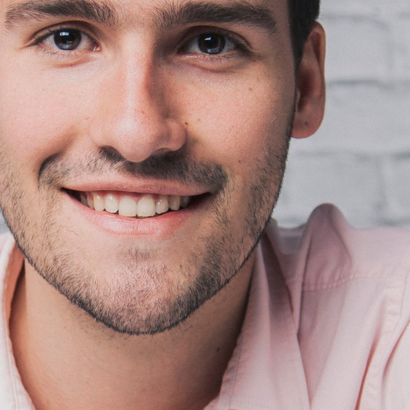 Papada Masculino|Depilación láser Alexandrita Pro de Candela