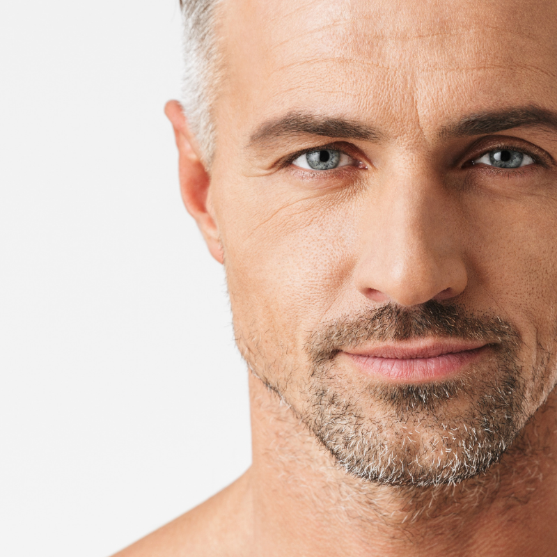 Perfilado de Barba Masculino |Depilación láser Alexandrita Pro de Candela