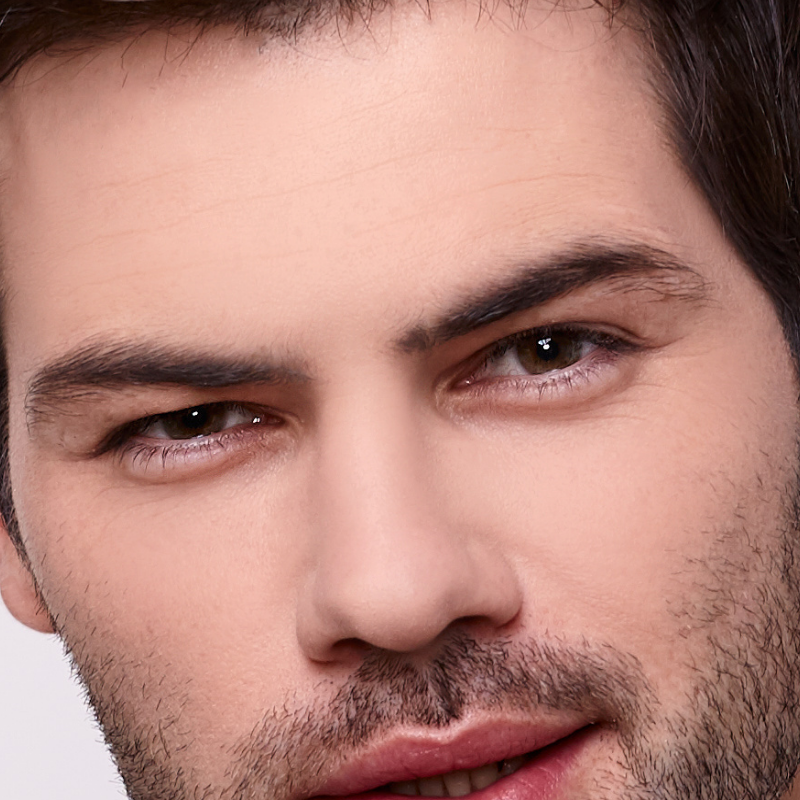 Pómulos Masculino|Depilación láser Alexandrita Pro de Candela