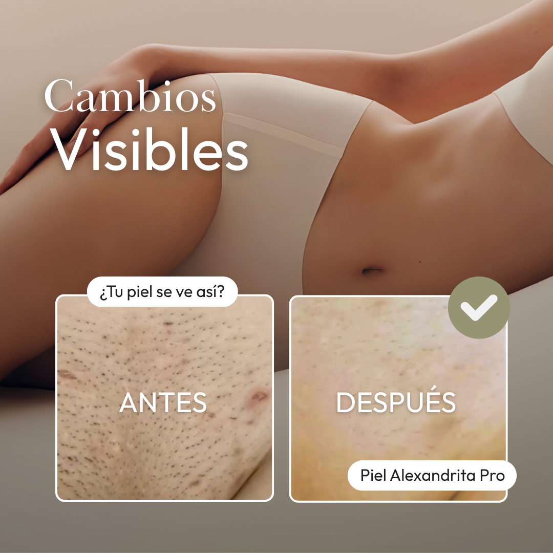 Medio Brazo Masculino|Depilación láser Alexandrita Pro de Candela