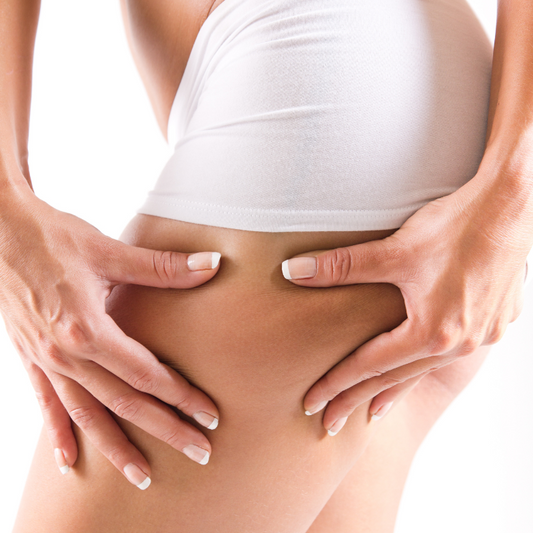 ESTRIAS EN GLUTEOS  |  Láser Chrome