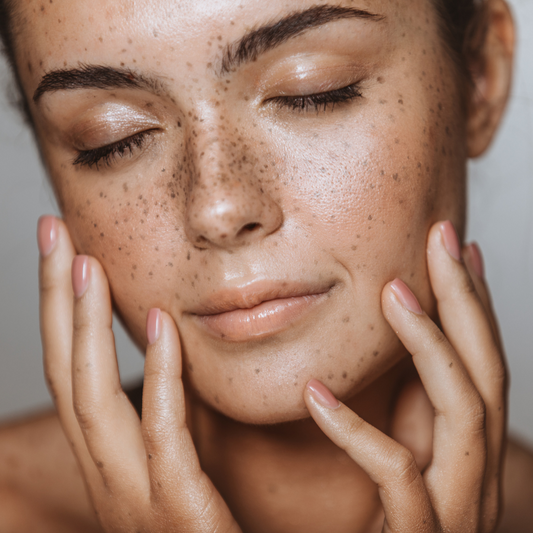 LASER CICATRICES  ROSTRO COMPLETO |  Láser Chrome